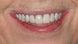 Woodyard Periodontics - Teeth Xpress™