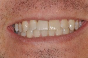 Woodyard Periodontics - Implant Dentistry