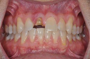 Woodyard Periodontics - Implant Dentistry